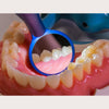 M1 Bright LED Dental Mirror - Enova Illumination