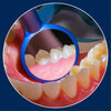 M1 Bright LED Dental Mirror